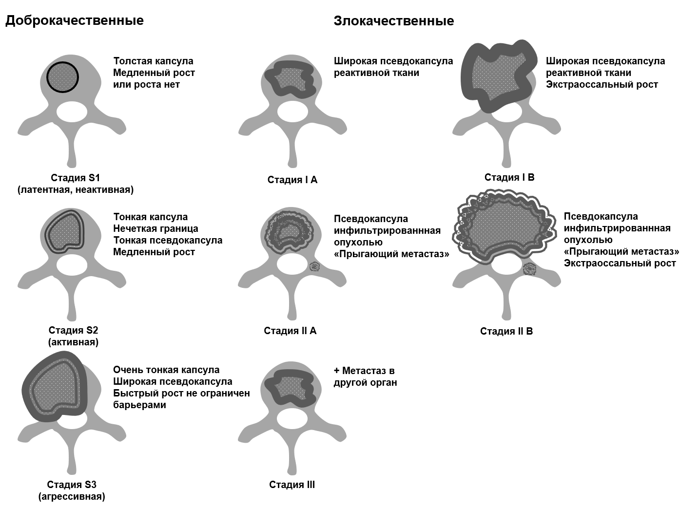 злокачественные опухоли схема, виды доброкачественных опухолей схема, злокачественная опухоль и доброкачественная отличие